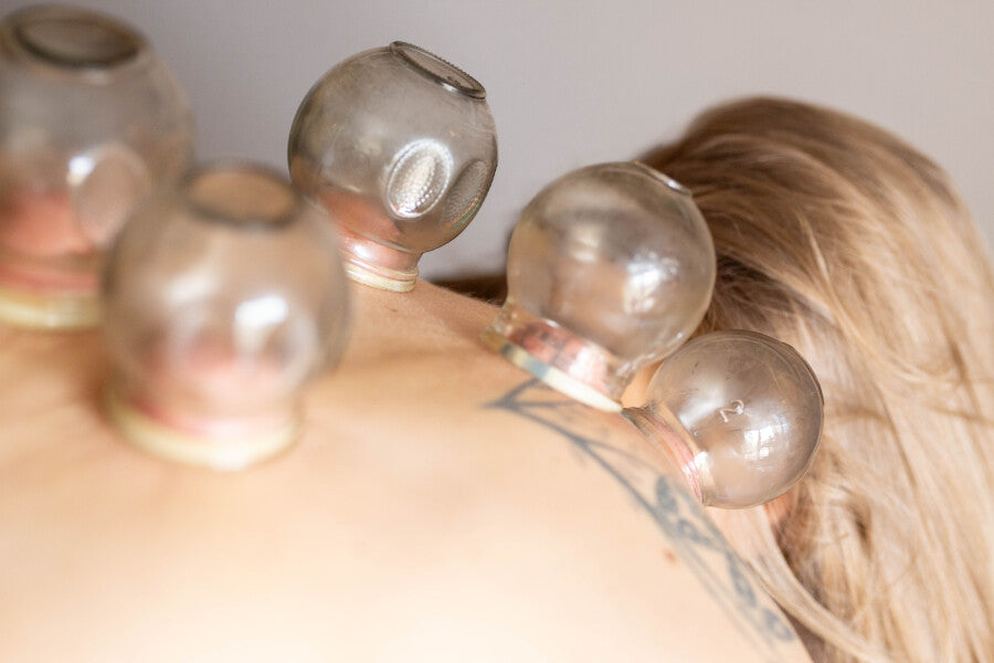 Cupping Benefits